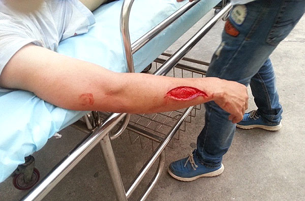 我司职工黄国良等被加多宝员工殴打 案件已被移送检察院审查起诉