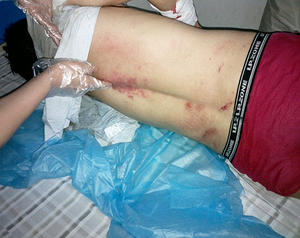 我司职工黄国良等被加多宝员工殴打 案件已被移送检察院审查起诉